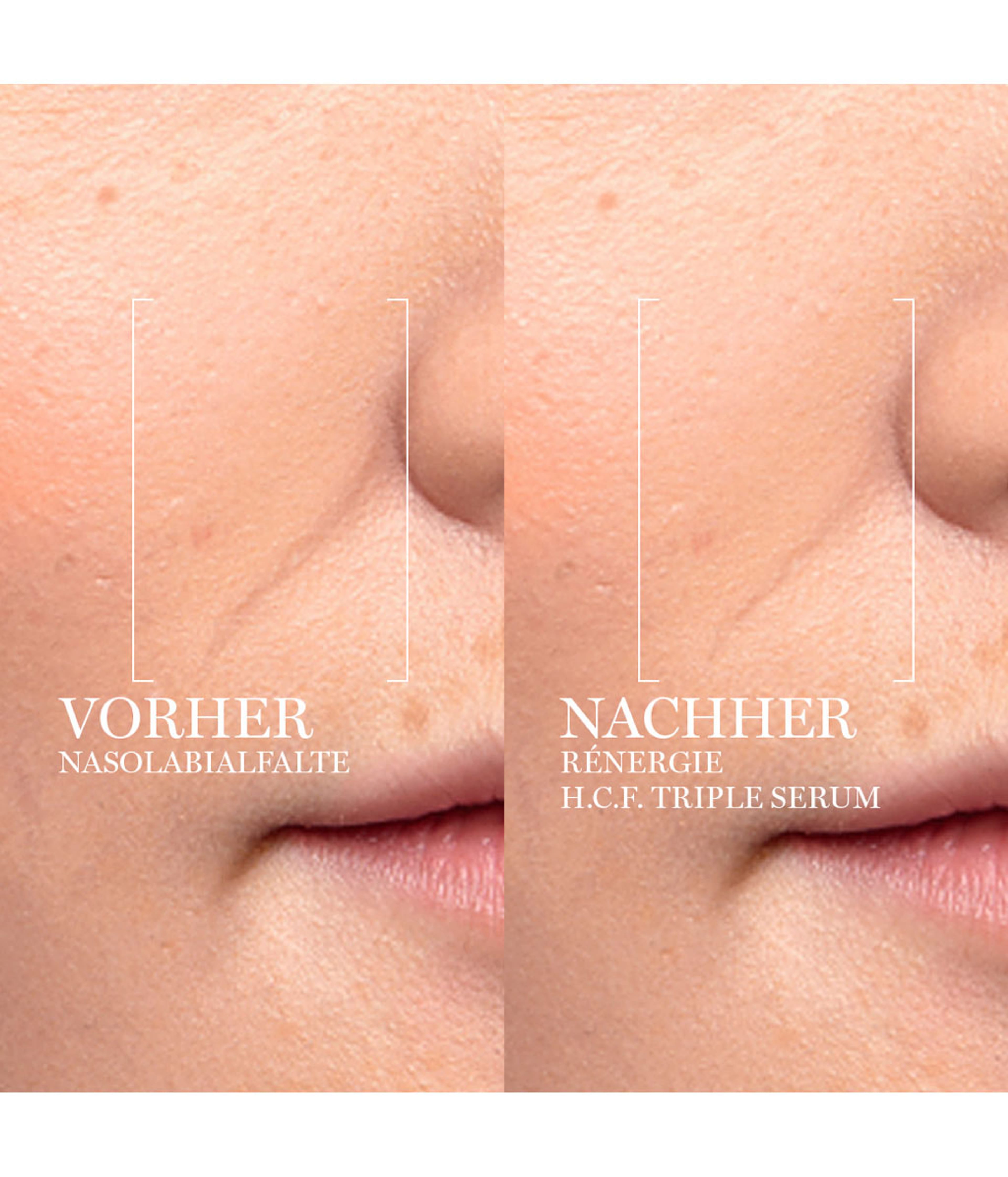 Zdjęcie produktu 4 z 6, LANCÔME Rénergie Serum do twarzy